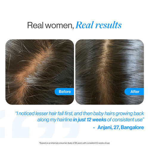 Advanced Hair Growth Serum Roll On - 3% Redensyl, 3% Rosemary (25 ml)