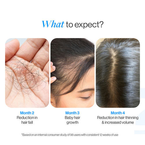 Advanced Hair Growth Serum Roll On - 3% Redensyl, 3% Rosemary (25 ml)