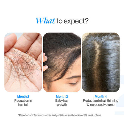Advanced Hair Growth Serum Roll On - 3% Redensyl, 3% Rosemary (25 ml)